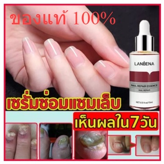 💥พร้อมส่งทันที💥เซรั่มบำรุงเล็บ ของแท้ 100% LANBENA  น้ำยาบำรุงเล็บ 15ml ต้านการติตเชื้อรา กันเล็บแตก เล็บเปราะ เล็บหนา