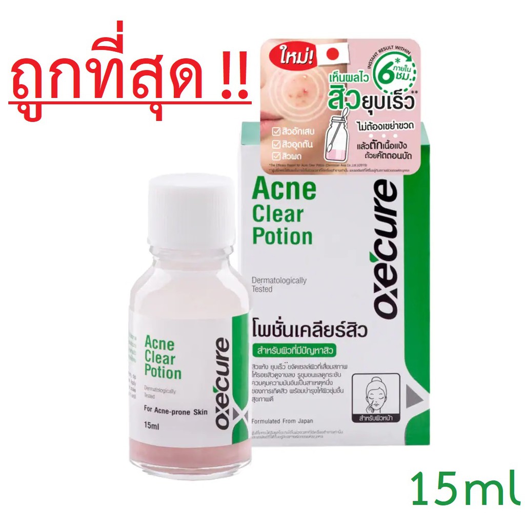 Oxecure Acne Clear Potion 1ขวด ขนาด15ml Oxe Cure อ๊อกซีเคียว แอคเน่ เคลียร์ โพชั่น {0228}