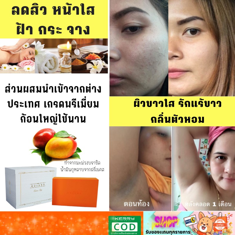สบู่ผิวขาว-ควินนส์ ขาวไว ขี้ไคลกระจุย ใช้ได้ทั้งหน้าและผิว ลดสิว ฝ้ากระ สะเก็ดเงิน ขาลายน้ำเหลืองไม่ดี