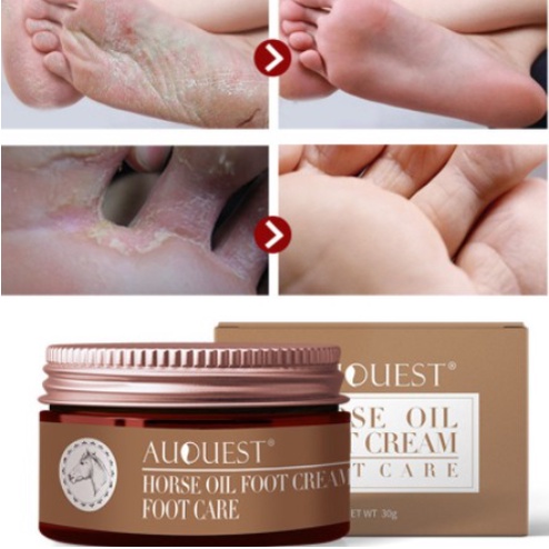 พร้อมส่ง ถูกที่สุด Foot Fix Cracked Heel Cream ครีมทาเท้าน้ำมันม้ากันเชื้อราส้นเท้าแตก 30ml (ไม่มีกล่อง)