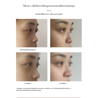 พร้อมส่ง🔥กัวซา นวดจมูก เรซิ่นนวดจมูก ที่นวดจมูก แผ่นกัวชา กวซานวดหน้าไม้ ดูแลผิวหน้าเ ครื่องมือความงาม