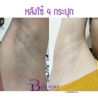 📌🌈โฉมใหม่💕Bootchy white snow queen บูชชี่ไวท์พร้อมส่ง