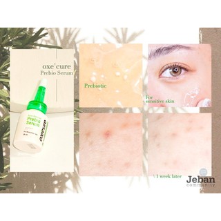 oxe cure serum
