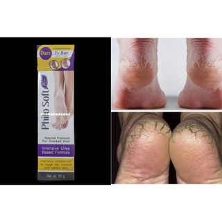 PHILOSOFT ฟิโลซอฟท์ครีมทาส้นเท้าแตก 💥💥ส่งไว 💥💥หายไวสุดปัง***ซื้อ1แถม1***