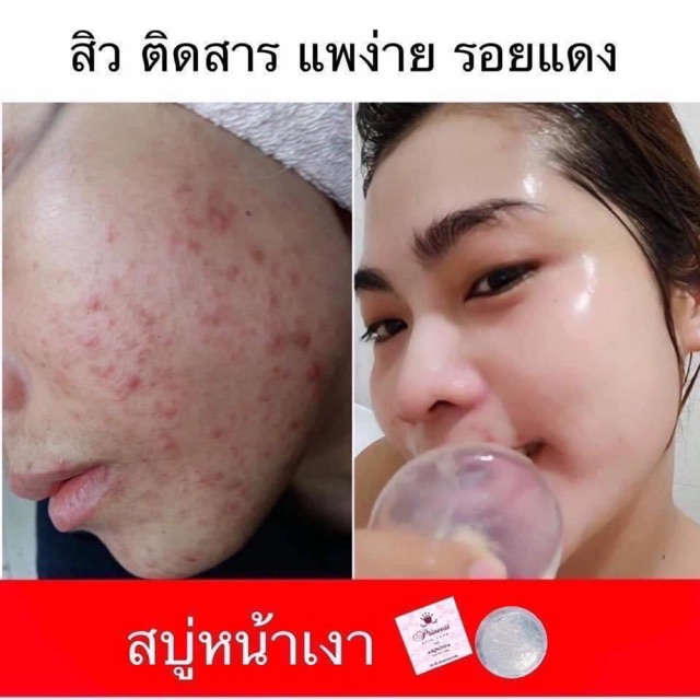 สบู่หน้าเงา Aura Aura Soap
