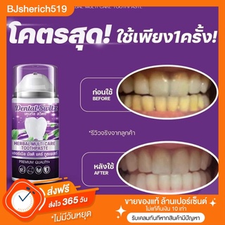 เจล ฟ อ กฟันขาว Dental switz