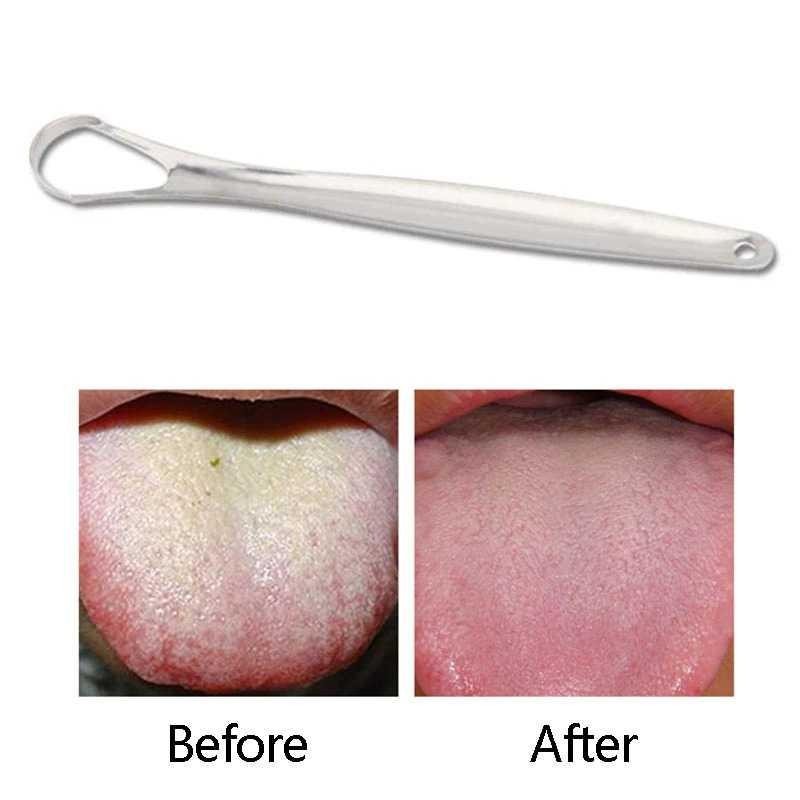 FourSoft Tongue Cleaner Tongue Oral Scraper Cleaner สแตนเลส - LO13