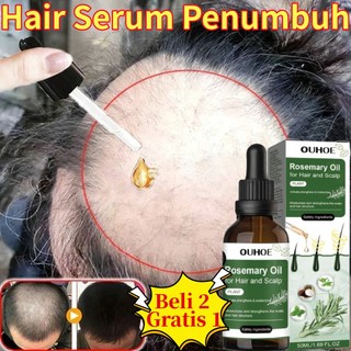 Mooncy Hair Serum Penumbuh Rambut Cepat Dan Tebal Rosemary Oil Serum Rambut Rontok Penumbuh Rambut Cepat Obat Penumbuh Rambut Botak Penebal Rambut Wanita
