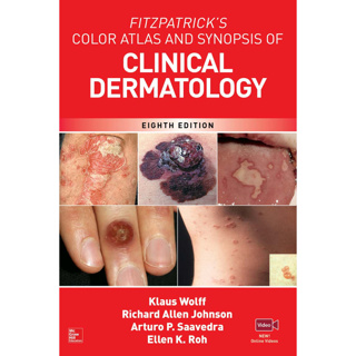 หนังสือยาสะเก็ดเงิน - Fitzpatricks Color Atlas and Synopsis of Clinical Dermatology รุ่นที่ 8 โดย Klaus Wolff