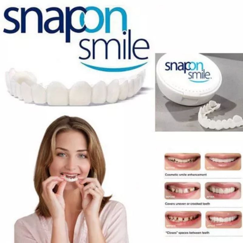 Snap ON SMILE Denture 1SET ฟันปลอมบนและล ่ าง - ฟันปลอมซิลิโคน