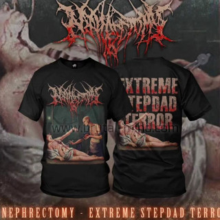 Nephrectomy เสื้อยืด - ExtremeStepdadTerror