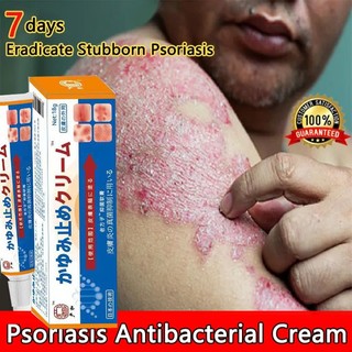 Japan Salep gatal Salep Eksim Salep kulit Krim psoriasis paling ampuh Kulit Kepala Psoriasis Tangan Tinea Kaki Bau Versicolor Menghambat Dermatitis Jamur Anti Gatal Cream Menghambat Dermatitis Jamur Anti Gatal Cream