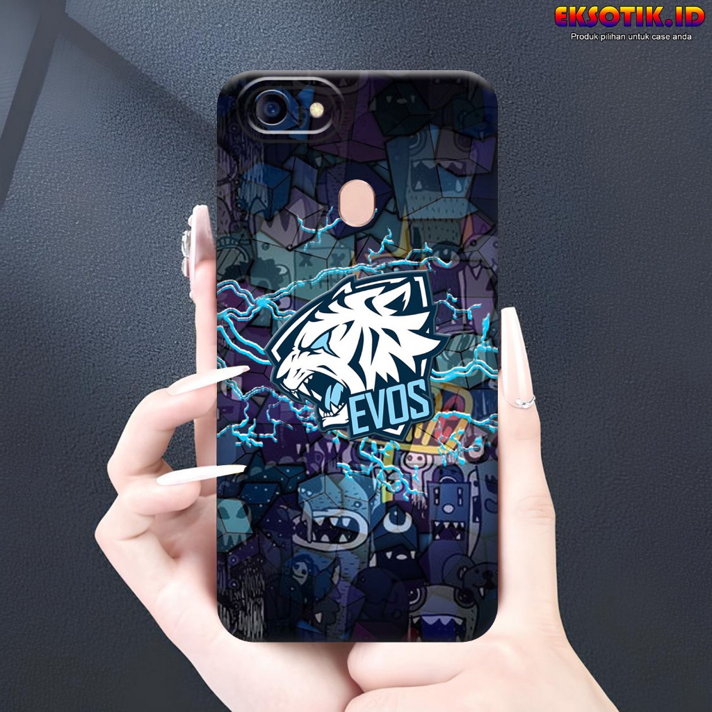 เคส Oppo F5 - เคส Oppo F5 - เคสแฟชั่นล่าสุด - Oppo F5 Silicone - Cool and Cute Motips - Oppo F5 Soft