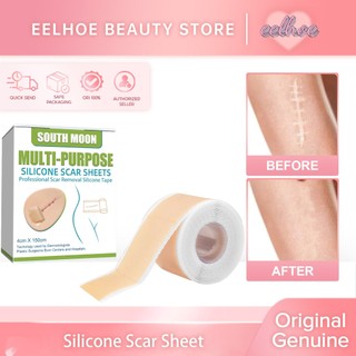 South Moon Silicone Scar Sheet 4*150cm Plester Penghilang Bekas Luka Keloid Patch Penutup Bekas Luka Dan Tato Perbaikan Kulit Keloid Plester Terapi Stretch Mark Perawatan Kulit Bekas Luka Bakar Dan Jerawat