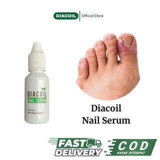 DIACOIL NAIL SERUM Obat Jamur Kuku Rusak Cantengan Bengkak Bernanah Menghitam ORI 100%