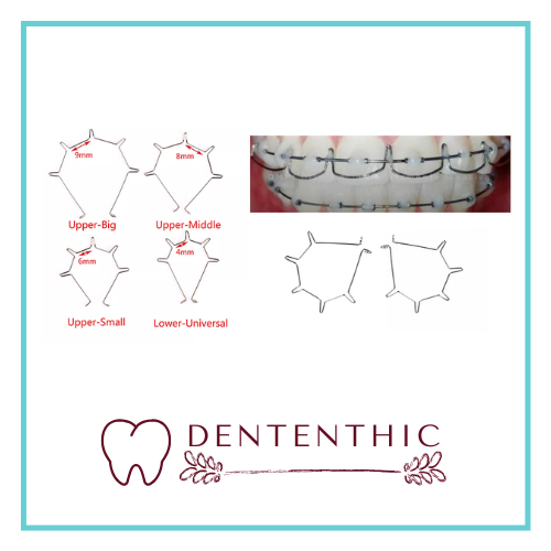 Dental Anterior Root Torque Torque Spring Auxiliary Ortho