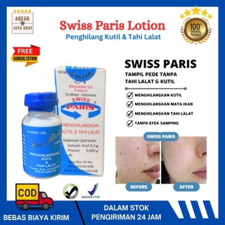 Swiss Paris Lotion 100% Asli Original Obat Ampuh Penghilang Kutil Leher Kelamin Tahi Lalat Tanpa Efek Samping