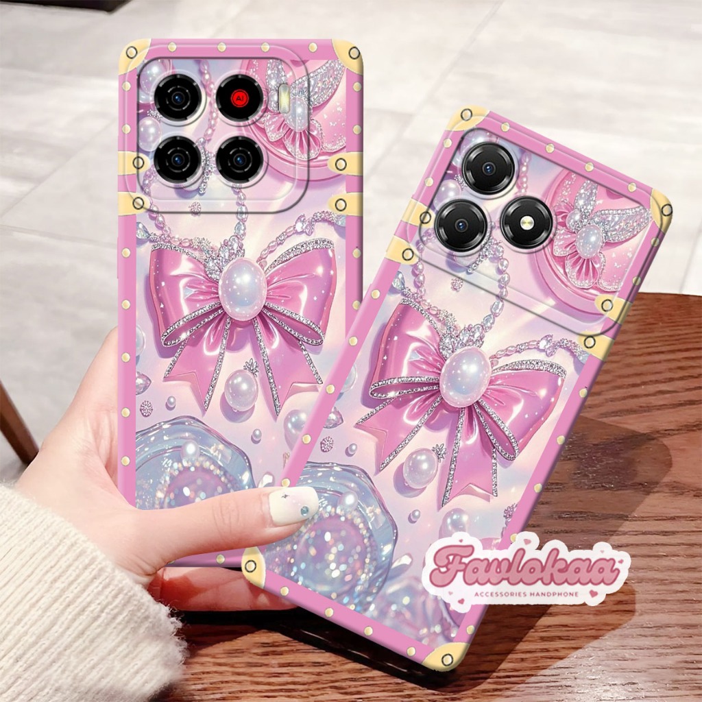 (FL02) เคส ZTE NUBIA A56 ZTE NUBIA A36 เคสแฟชั่นล่าสุด Procamera Softcase ซิลิโคน Tpu