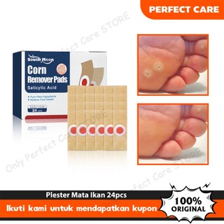 Beli 2 Gratis 1/Ready South Moon Plester Mata Ikan 24pcs Penghilang Kutil Penghilang Mata Ikan Kapalan Foot Corn Removal Plester Obat Kutil dan Mata Ikan Ji Yan Gao Krim Penghilang Kutil
