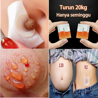 Koyo pelangsing Mengecilkan perut buncit wanita Penurun berat badan Penghilang lemak perut Penghilang double chin