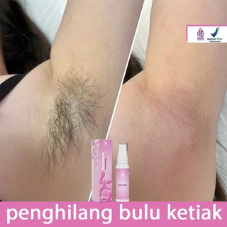 Perontok bulu permanen perontok bulu kemaluan cukuran bulu kemaluan perontok bulu ketiak 20ml penghilang bulu permanen hair removal cream pembersih bulu ketiak penghilang bulu kaki lengan paha hair removal spray bisa dipakai ibu hamil lembut