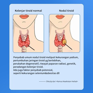 Salep Obat Gondok Kelenjar Tiroid & Getah Bening Herbal Ampuh 20g Original Aman untuk Penggunaan Jangka Panjang