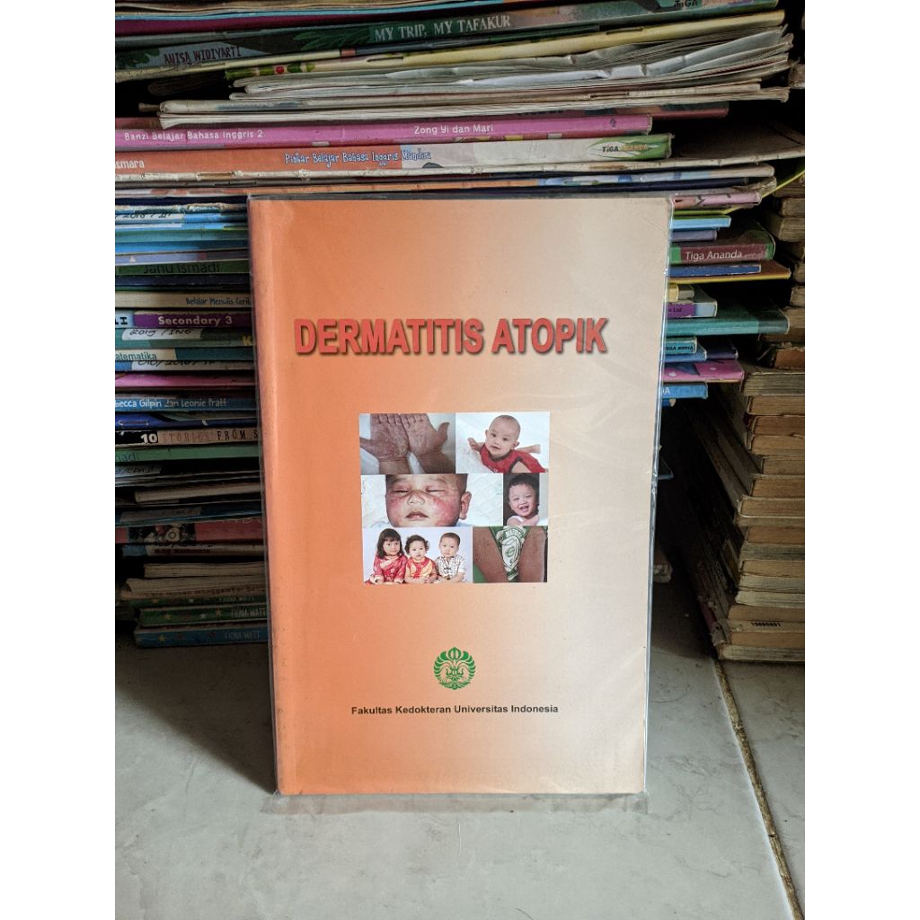 FKUI Atopic Dermatitis Book