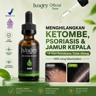 Serum Anti Ketombe Ampuh & Obat Ketombe Parah - Bantu Redakan Gatal & Kulit Kepala Berkerak - BPO