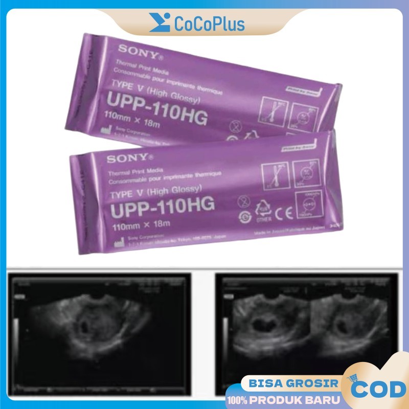 Original Sony 110Hg กระดาษกระดาษความร้อนมันวาวสูงสําหรับเครื่องพิมพ์ Sony Ultrasound Store USG ผลการ