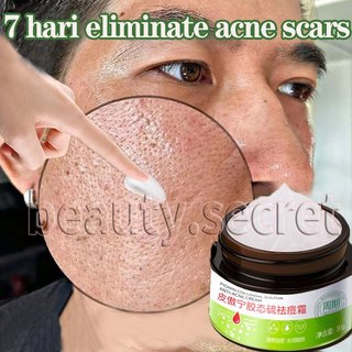 Bekas Jerawat Krim 30g Untuk Kulit Berminyak & Jerawat Sensistif | Melembabkan & Memeperbaiki Skin Barrier Dengan Kandungan Tea Tree Oil Redakan Jerawat Meradang & Bekasnya Aman untuk Kulit Sensitif Mengecilkan pori pori wajah jerawat