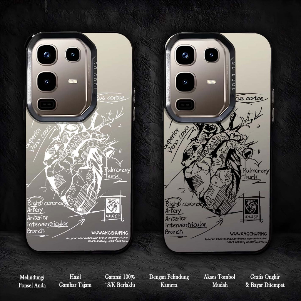 เคส HP Premium Infinix Note 50 50s Note 50 Pro - เคสใหม่ล่าสุด Infinix Note 50 50s Note 50 Pro - Sil