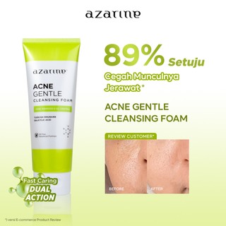Azarine Acne Gentle Cleansing Foam 75ml Sabun Cuci Muka Acne Prone Skin Kulit Berjerawat