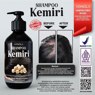 [ BPOM & HALAL ] Shampo Kemiri Penumbuh Rambut Cepat Anti Ketombe Penghilang Uban dan Rontok - 500ml TERLARIS & VIRAL