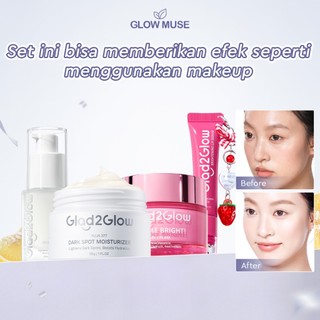 [100% ORI]Glad2Glow  Dark Spot Bundle all in 1 - 2/3/4/5 PCS-Yuja Symwhite 377 Dark Spot Moisturizer+Yuja Symwhite 377 Dark Spot Serum+Milk Cleanser+Brightening Moisturizer+Brightening Toner Meringankan flek hitam mencerahkan warna kulit