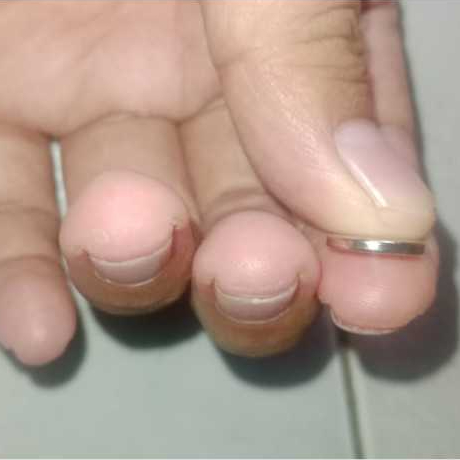 แม่เหล็กนีโอไดเมียม N52 STRONG 12x2