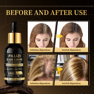FILLIZI Serum Pertumbuhan Rambut,Rambut Berkembang,Mencegah Rambut Rontok,Penumbuh Rambut 55ML