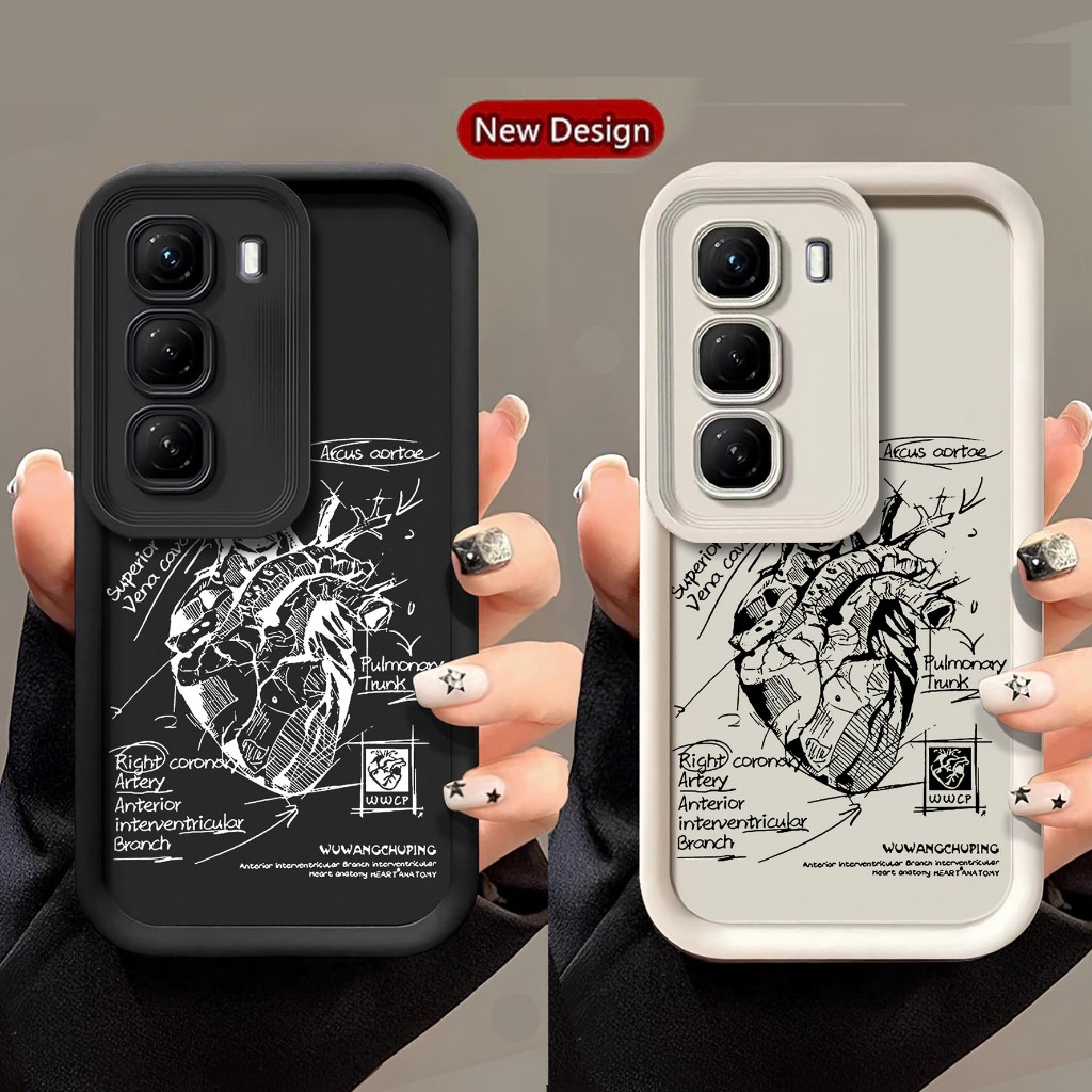 SOFTCASE PRO กล้องยาง HOT 60i HOT 60 PRO HOT 60 PRO PLUS - SOFTCASE HOT 60i HOT 60 PRO HOT 60 PRO PL