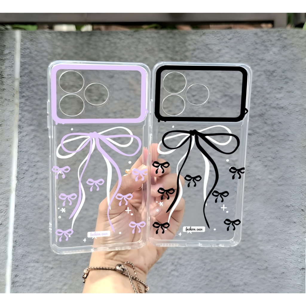 Softcase ZTE NUBIA A36 Case Clear Motif Casing ZTE NUBIA A36 ซิลิโคนใสล่าสุด