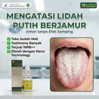 Obat lidah Putih Berjamur, Benjolan Di Lidah, Lidah Mati Rasa Sariawan Luka - Propolis SM Brazilian
