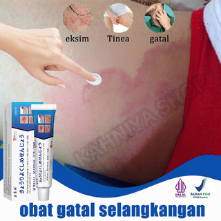 Salep gatal paling ampuh salep jamur kulit gatal selangkangan dan hitam salep eksim salap gatal kulit yang ampuh