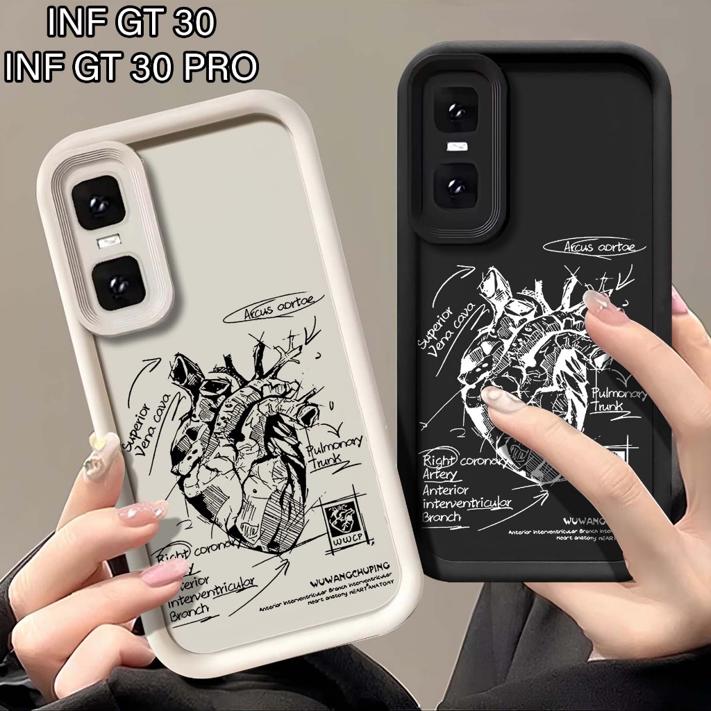 Softcase Procamera นูน Infinix GT 30 GT 30 Pro - เคสยาง Infinix GT 30 GT 30 Pro - Silicone Infinix G