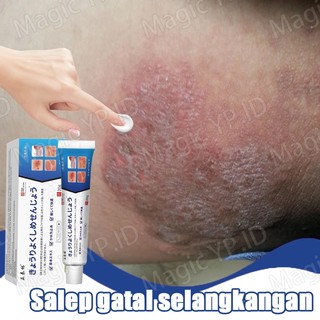 Salep Eksim salep selangkangan gatal 20g Obat Scabies Obat Kurap Salep Jamur Kulit Paling Ampuh