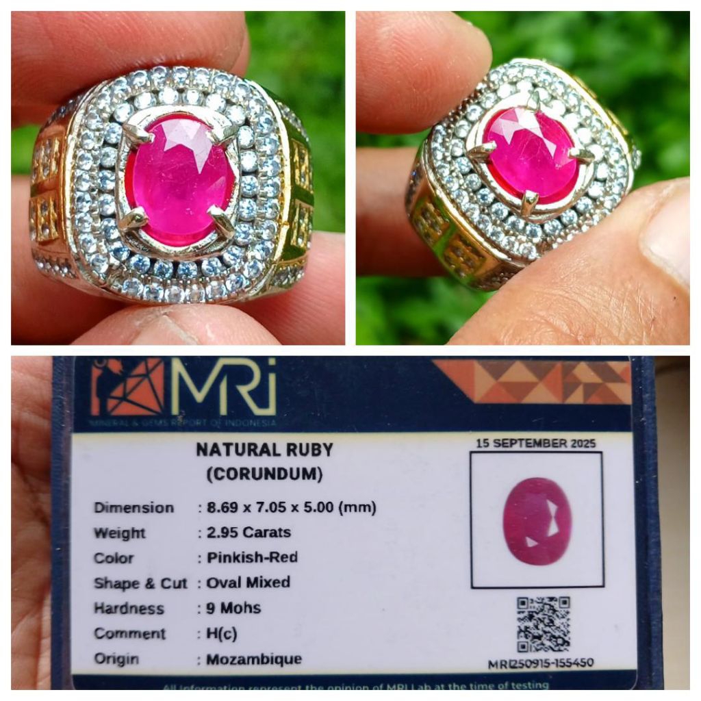 บันทึกโมเสคทับทิมธรรมชาติ MRI