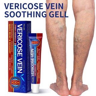 FILLIZI Krim Varises Herbal Bantu Lancarkan Peredaran Darah Kurangi Bengkak & Nyeri Kaki Sehari-hari