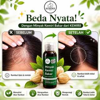 Minyak Kemiri Bakar 100% Original 100 ml - Penumbuh rambut alis asli | Hair oil serum growth rambut anti rontok kering bercabang | Penumbuh pemanjang pelebat rambut pria mengurangi rontok & ketombe |