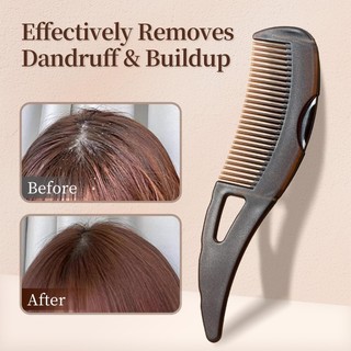 Jual Dandruff Massage Comb Sisir Anti Ketombe Sisir Rambut Anti Statis Dan Kusut