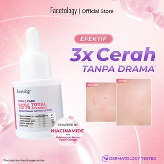 Exclusive Facetology Triple Care 15% Total Advanced Brightening Active Serum 15ML Serum Pencerah Bantu Samarkan Bekas Jerawat, Meratakan Warna Kulit, Melindungi Skin Barrier & Melembabkan Kulit All Skin Type