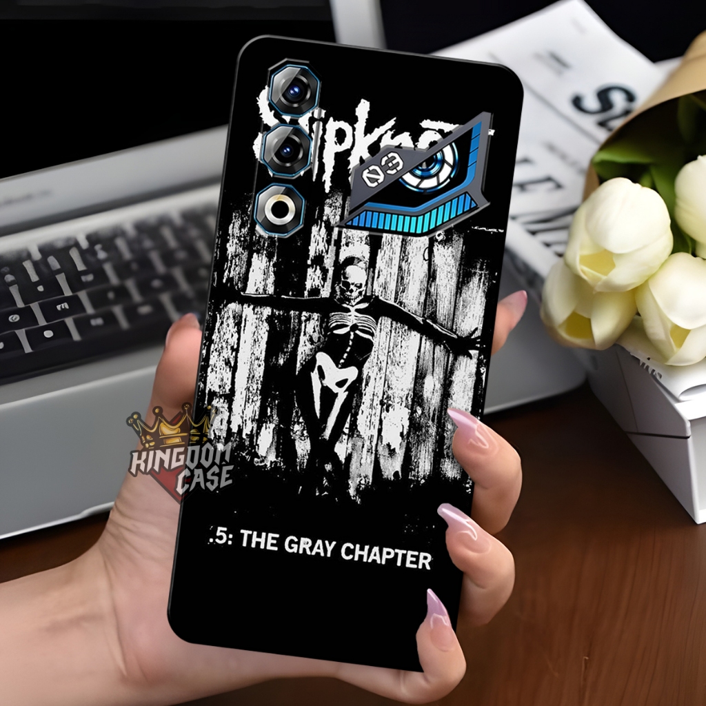 HP Kingdomcase - เคส Zte Nubia Neo 3 GT Casing 2025 ใหม่ล่าสุด | ZTE NEO 3 GT เคสยืดหยุ่น 2025 ปกป้องกล้อง - เคสแฟชั่น - เคสอ่อนอินเทรนด์ - เคสโทรศัพท์มือถือ - เคสเย็น 2025 - อุปกรณ์เสริมมือถือ - ดีไซน์สร้างสรรค์ - Hotinga Rajaca