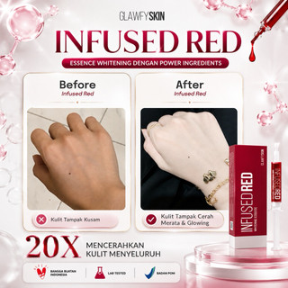 Glawfyskin - [ dapat 1 ] Infused Red Whitening Essence