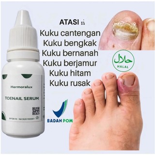 Hermoralux Obat Kuku Cantengan & Jamur Kuku Ampuh | Serum Perawatan Kuku Rusak, Tebal & Kuning